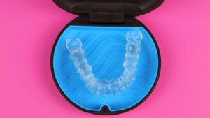 Invisalign Aligners